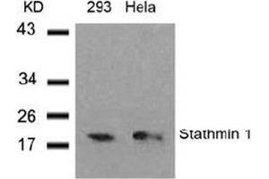 Image no. 3 for anti-Stathmin 1 (STMN1) (Ser37) antibody (ABIN197457) (Stathmin 1 antibody  (Ser37))