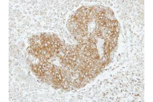 IHC-P Image Immunohistochemical analysis of paraffin-embedded SAS xenograft, using GABARAPL2, antibody at 1:100 dilution. (GABARAPL2 antibody  (Center))