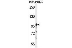 AXIN1 Antibody (C-term) western blot analysis in MDA-MB435 cell line lysates (35µg/lane).
