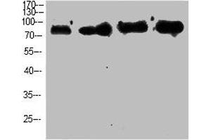 Western Blot analysis of customer's using p63 Polyclonal Antibody. (p63 antibody  (N-Term))