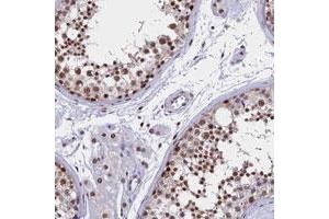 Immunohistochemical staining of human testis with CCDC97 polyclonal antibody  shows strong nuclear positivity in cells in seminiferus ducts and nuclear membrane staining in Leydig cells at 1:500-1:1000 dilution. (CCDC97 antibody)