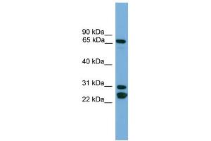 WB Suggested Anti-DNAI2  Antibody Titration: 0. (DNAI2 antibody  (N-Term))