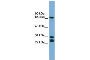 WB Suggested Anti-DNAI2  Antibody Titration: 0.