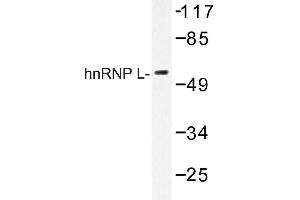 Image no. 1 for anti-Heterogeneous Nuclear Ribonucleoprotein L (HNRNPL) antibody (ABIN272168) (HNRNPL antibody)