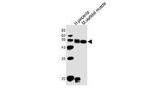 All lanes : Anti-DLK1 Antibody (C-term) at 1:1000 dilution Lane 1: human placenta lysates Lane 2: mouse skeletal muscle lysates Lysates/proteins at 20 μg per lane. (DLK1 antibody  (C-Term))