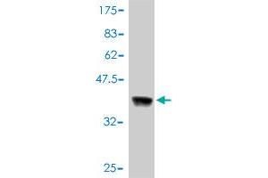 Western Blot detection against Immunogen (37. (ErbB2/Her2 antibody  (AA 22-121))