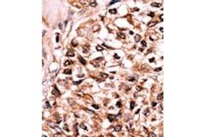 Image no. 2 for anti-Fas (TNFRSF6)-Associated Via Death Domain (FADD) (pSer191) antibody (ABIN358126) (FADD antibody  (pSer191))