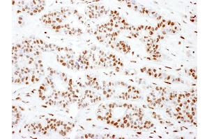 anti-Sjogren Syndrome Antigen B (SSB) (AA 358-408) antibody