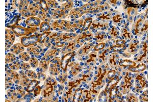 ABIN6260462 and ABIN6278357 at 1/100 staining Mouse kidney tissue by IHC-P.