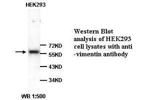 Image no. 1 for anti-Vimentin (VIM) (Internal Region) antibody (ABIN791058) (Vimentin antibody  (Internal Region))