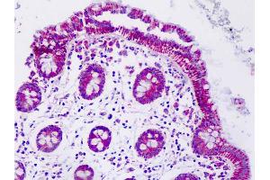 Anti-MNSOD / SOD2 antibody IHC staining of human colon. (SOD2 antibody)