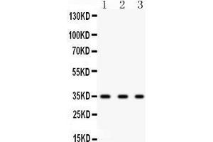 Western Blotting (WB) image for anti-Secreted Protein, Acidic, Cysteine-Rich (Osteonectin) (SPARC) (AA 268-303), (C-Term) antibody (ABIN3043352) (SPARC antibody  (C-Term))