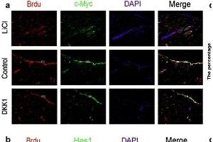 The relationships of the Wnt and Notch signaling pathway and the proliferation of epidermal stem cells was analyzed by immunofluorescence. (c-MYC antibody  (AA 101-200))