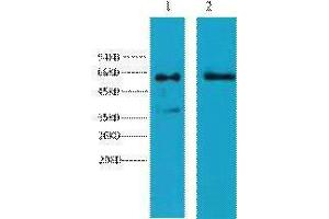Western Blotting (WB) image for anti-Keratin 6 (KRT6) antibody (ABIN3181150) (Keratin 6 antibody)