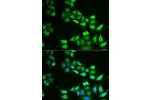 Immunofluorescence analysis of HeLa cell using CCBL1 antibody. (CCBL1 antibody)