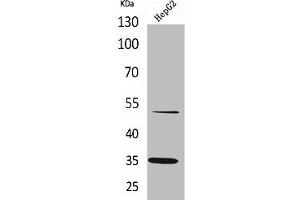 Western Blot analysis of HepG2 cells using TFPI Polyclonal Antibody (TFPI antibody  (C-Term))