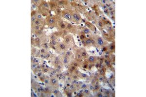 UGT2B15 Antibody immunohistochemistry analysis in formalin fixed and paraffin embedded human liver tissue followed by peroxidase conjugation of the secondary antibody and DAB staining. (UGT2B15 antibody  (AA 156-185))