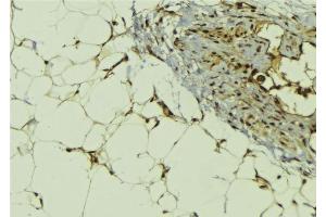ABIN6278791 at 1/100 staining Human lung tissue by IHC-P. (MBIP antibody  (Internal Region))