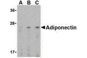 Western Blotting (WB) image for anti-Adiponectin (ADIPOQ) (C-Term) antibody (ABIN2477286) (ADIPOQ antibody  (C-Term))