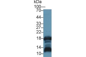 Detection of GKN1 in Rat Stomach lysate using Polyclonal Antibody to Gastrokine 1 (GKN1) (Gastrokine 1 antibody  (AA 27-151))