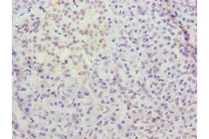 Immunohistochemistry of paraffin-embedded human pancreatic tissue using ABIN7159667 at dilution of 1:100 (METTL25 antibody  (AA 206-455))
