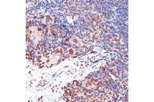 Immunohistochemistry of paraffin-embedded mouse spleen using  Rabbit mAb (ABIN3016894, ABIN3016895, ABIN3016896, ABIN1679361 and ABIN1679362) at dilution of 1:100 (40x lens). (ALOX5 antibody)