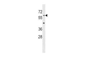 AOAH Antibody (Center) (ABIN1537935 and ABIN2848953) western blot analysis in mouse liver tissue lysates (35 μg/lane). (AOAH antibody  (AA 168-197))