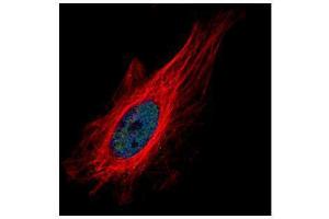 ICC/IF Image Confocal immunofluorescence analysis (Olympus FV10i) of paraformaldehyde-fixed HeLa, using ZNF449, antibody (Green) at 1:500 dilution. (ZNF449 antibody)