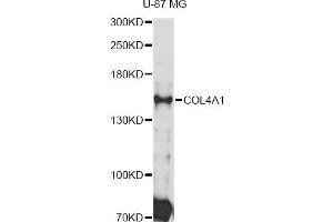 Western blot analysis of extracts of U-87 MG cells, using COL4A1 Antibody (ABIN4903336) at 1:3000 dilution. (COL4A1 antibody)