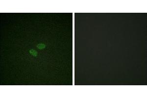 Peptide - +Immunofluorescence analysis of HeLa cells, using CDC16/APC6 (Ab-560) antibody. (CDC16 antibody  (Ser560))
