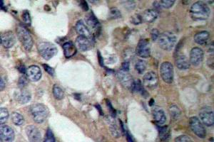 Image no. 1 for anti-Heat Shock 27kDa Protein 1 (HSPB1) antibody (ABIN265470) (HSP27 antibody)