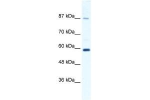 KIF23 antibody used at 1. (KIF23 antibody  (N-Term))