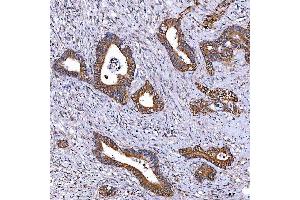 IHC analysis of TOMM34 using anti-TOMM34 antibody (ABIN7599253). (TOMM34 antibody  (AA 1-309))