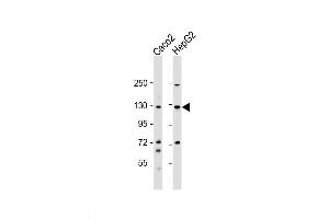 Western Blot at 1:1000 dilution Lane 1: Caco2 whole cell lysate Lane 2: HepG2 whole cell lysate Lysates/proteins at 20 ug per lane. (UBE4A antibody  (AA 451-479))