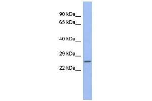 ZNRF1 antibody used at 0. (ZNRF1 antibody  (N-Term))