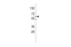 PRK (Thr172) Antibody (ABIN654800 and ABIN2844475) western blot analysis in K562 cell line lysates (35 μg/lane). (PRKAA2 antibody  (Thr172))