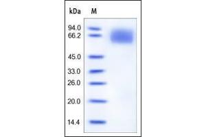 Human IL-6 R alpha, His Tag on SDS-PAGE under reducing (R) condition. (IL6RA Protein (AA 20-365) (His tag))