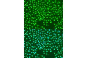 Immunofluorescence analysis of U2OS cells using SKP2 antibody (ABIN6134429, ABIN6147821, ABIN6147823 and ABIN6214002) at dilution of 1:100. (SKP2 antibody)