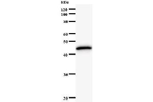 Western Blotting (WB) image for anti-K(lysine) Acetyltransferase 5 (KAT5) antibody (ABIN931130) (KAT5 antibody)
