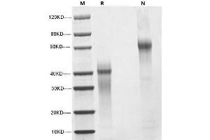 2 μg of IL-12, Human was resolved with SDS-PAGE under reducing (R) and non-reducing (N) conditions and visualized by Coomassie Blue staining. (IL12 Protein (AA 23-219, AA 23-328))