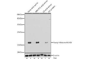 Western blot analysis of extracts of various cell lines, using Acetyl-Histone H3-K9 antibody (ABIN7267675) at 1:1000 dilution. (Histone 3 antibody  (H3K9))