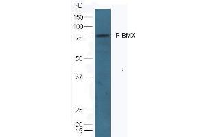 Lane 1: mouse lung lysates Lane 2: mouse kidney lysates probed with Anti-BMX (Tyr566) Polyclonal Antibody, Unconjugated  at 1:5000 90min in 37˚C. (BMX antibody  (pTyr566))