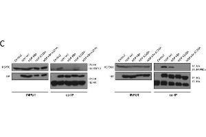 Western Blotting (WB) image for anti-Heat Shock Protein 70 (HSP70) antibody (ABIN361707)