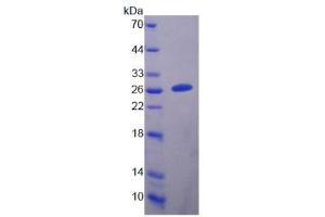 Image no. 1 for Dihydropyrimidinase-Like 5 (DPYSL5) (AA 1-205) protein (His tag) (ABIN4990273)