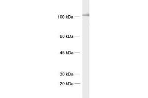 dilution: 1 : 1000, sample: synaptic membrane fraction of rat brain (LP1) (LRFN4 antibody)