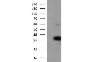 HEK293T cells were transfected with the pCMV6-ENTRY control (Left lane) or pCMV6-ENTRY ZFAND2B (Right lane) cDNA for 48 hrs and lysed. (ZFAND2B antibody)