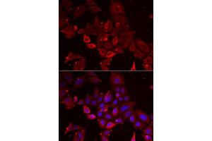 Immunofluorescence analysis of U2OS cells using MYOT antibody. (Myotilin antibody  (AA 259-314))