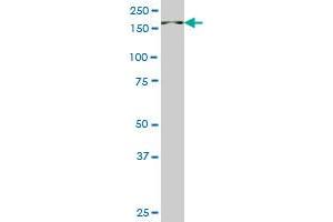 PIK3C2B monoclonal antibody (M06), clone 1H4. (PIK3C2B antibody  (AA 1-110))