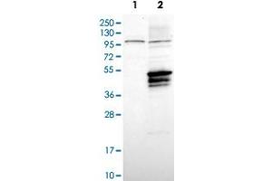 Western Blot analysis of Lane 1: negative control (vector only transfected HEK293T cell lysate) and Lane 2: over-expression lysate (co-expressed with a C-terminal myc-DDK tag in mammalian HEK293T cells) with USP2 polyclonal antibody .
