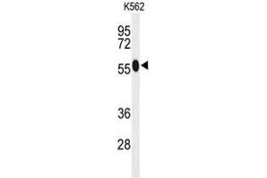 Western blot analysis of ACSM1 Antibody (N-term) in K562 cell line lysates (35µg/lane).